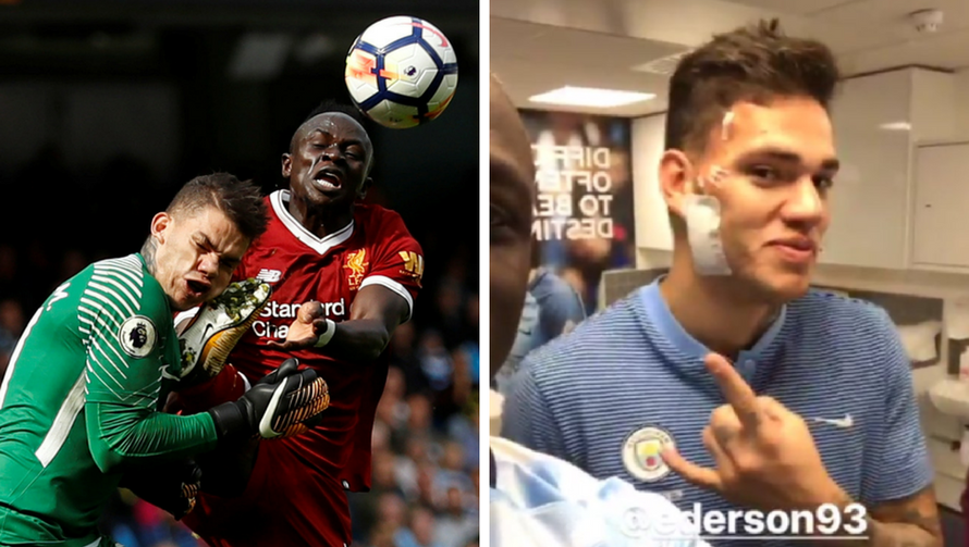 Skoro unakazio protivnika, a njegov klub se buni zbog kazne