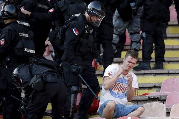 An injured Red Star Belgrade fan sits during clashes with riot police in the stadium before their Serbian Superliga soccer match against Partizan Belgrade in Belgrade