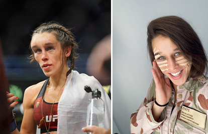 Skoro kao nova: UFC borkinja oporavila se od deformacije lica