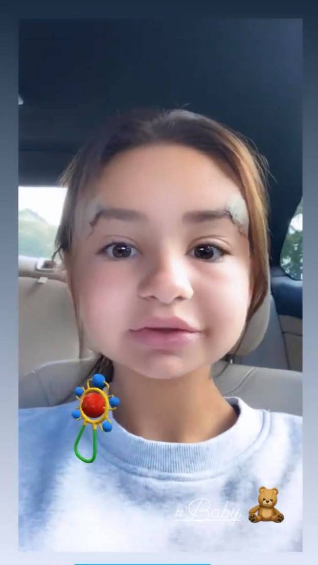 Na kirurga koji je unakazio žene žalila se i Kristina Mandarina. Evo što je njoj operirao...