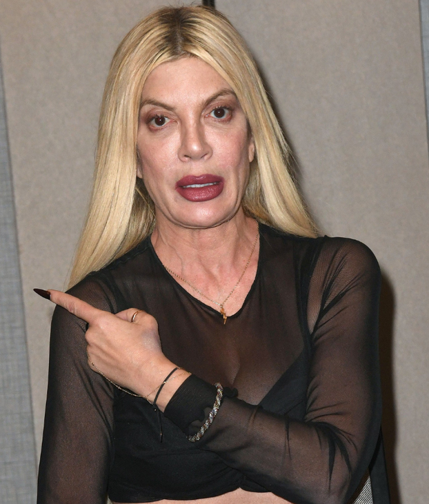 FOTO Tori Spelling prvi put išla 'pod nož' sa 16 godina: Kroz karijeru često šokirala izgledom