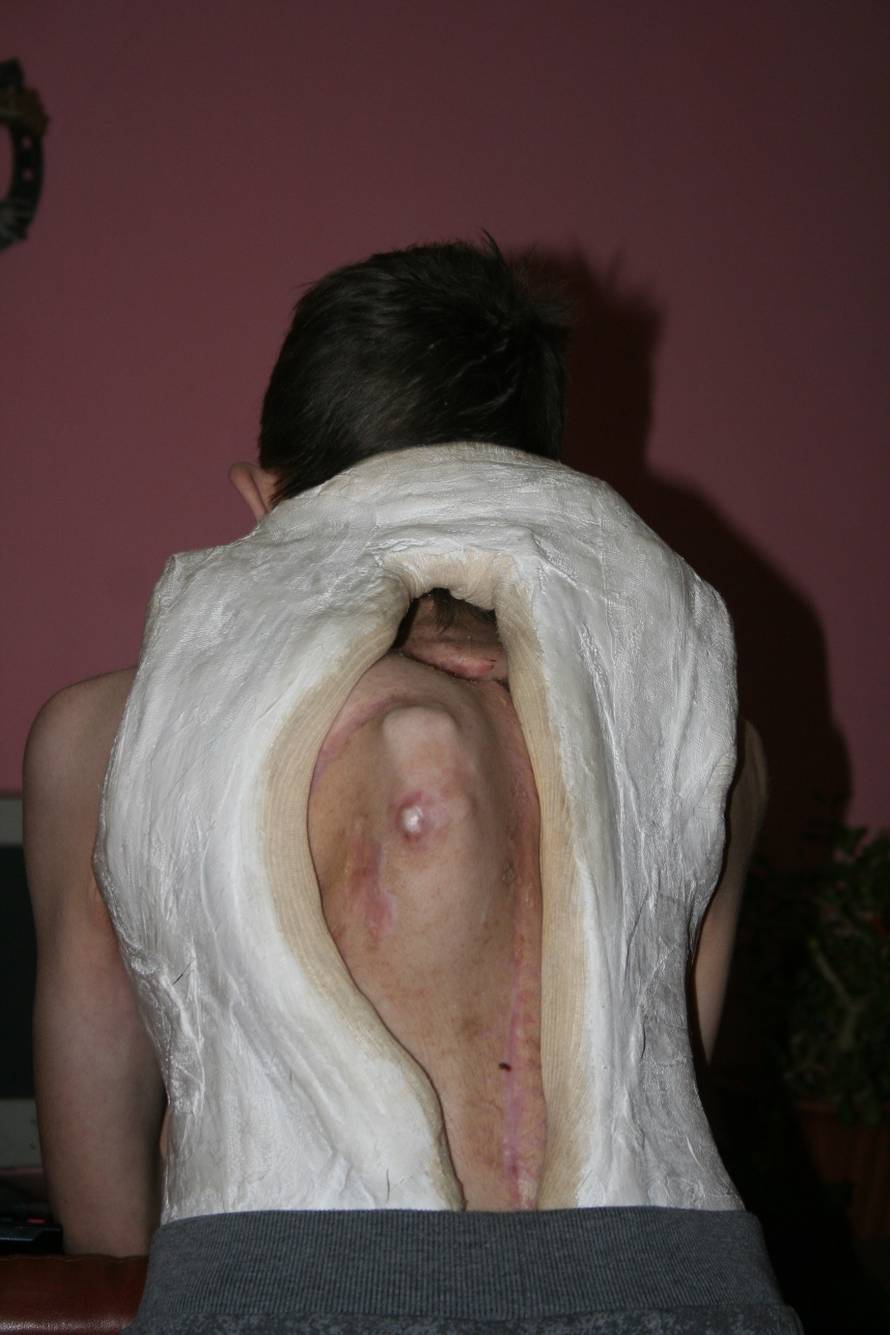 Samo se želim probuditi zdrav, ići u školu, igrati se i uživati