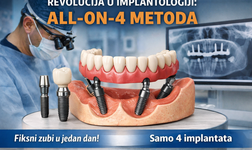 Revolucija u implantologiji: All-on-4 metoda