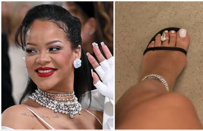 Rihanna je natečena trudnička stopala ukrasila dijamantima...