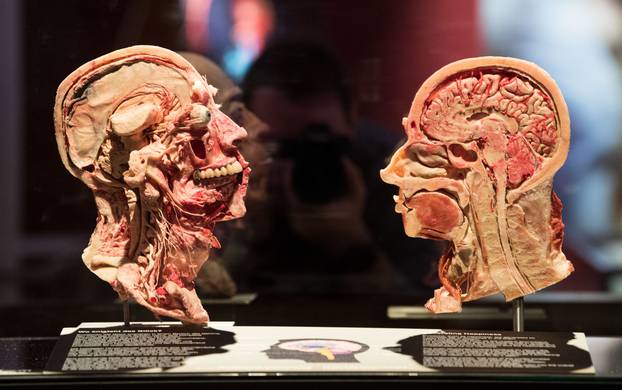 Body Worlds