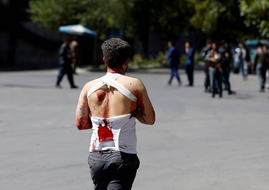 An Injured Afghan man walks on the street near a hospital after a blast in Kabul, Afghanistan