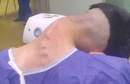 Mladić (23) pati od 'sindroma pale glave' - liječnici misle da je uzrok teška ovisnost o drogama