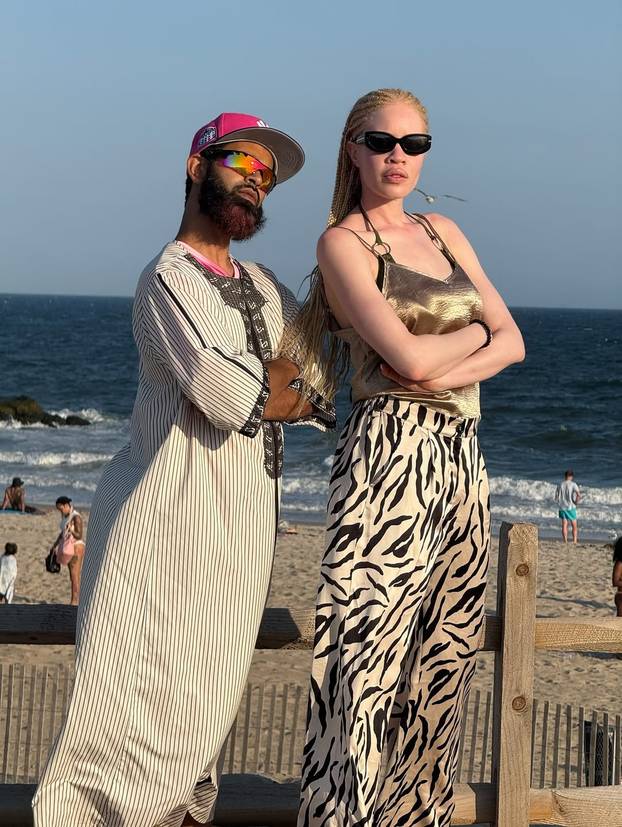 FOTO Afrikanka s albinizmom osvaja modnu industriju: 'Često privlačim znatiželjne poglede'