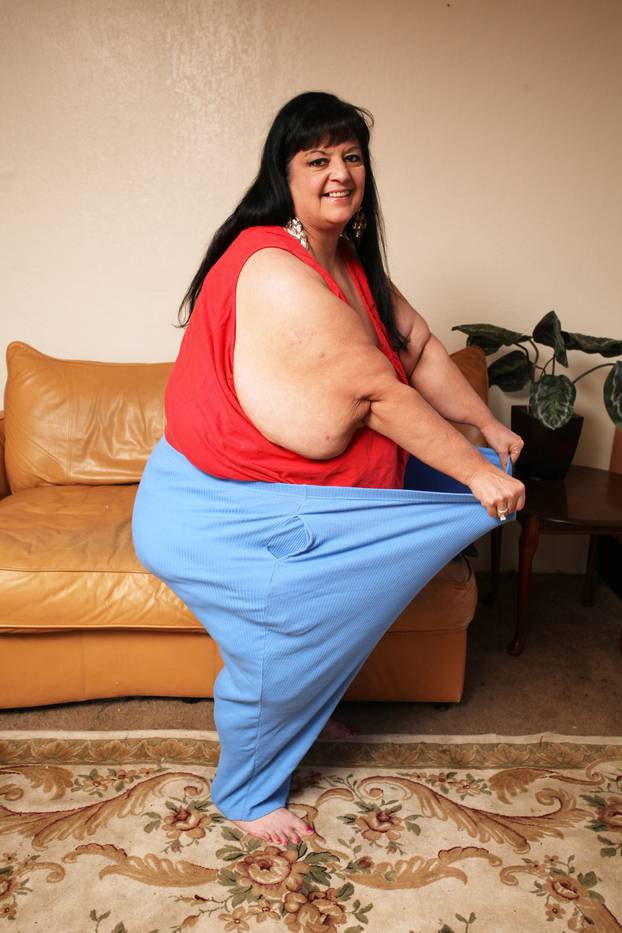 Former Weight-Gain Queen Drops 240lbs To Save Her Life