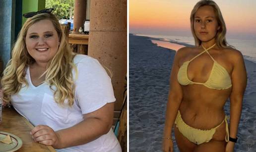 FOTO 'Dečki su me ostavljali zbog moje kilaže. Izgubila sam 80 kg i sad me žele natrag...'