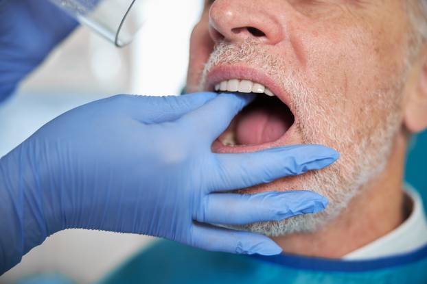 Aging man keeping his mouth open for a dentist
