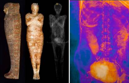 Poljski znanstvenici otkrili prvu trudnu mumiju na svijetu