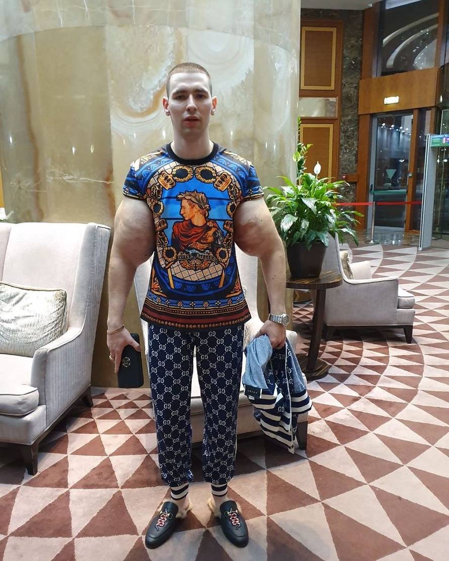 Skoro je ostao bez ruku, ostavio se MMA i počeo snimati porniće