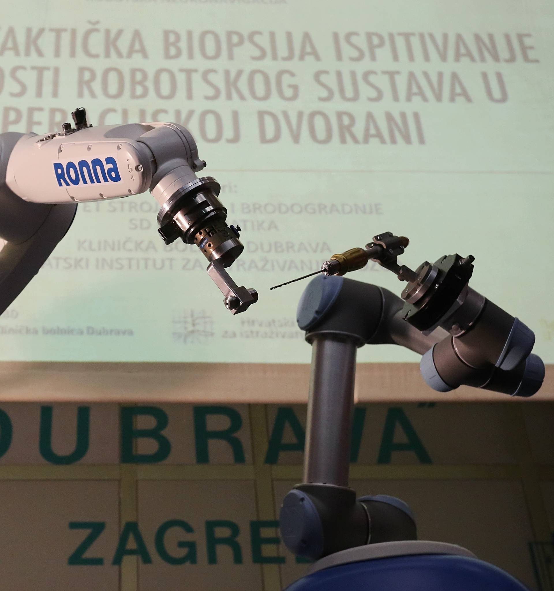 Hrvatski robot Ronna operirao pacijenta s tumorom na mozgu