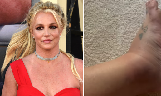 Britney Spears nakon incidenta pokazala natečeno stopalo: 'Za sve je kriva moja mama...'