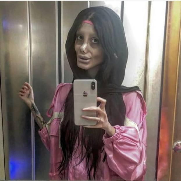 FOTO Sjećate se iranske 'zombi Angeline Jolie'? Ovako izgleda zapravo, a evo i zašto je nestala