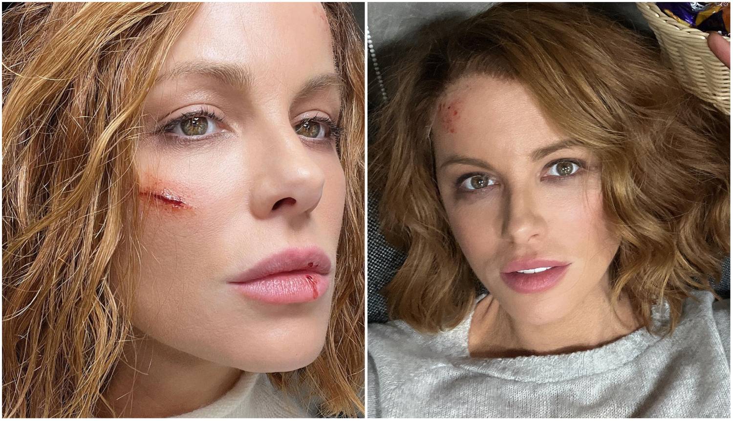 Vizažistica Tatjana o povredama Kate Beckinsale: 'Ozljede nisu stvarne, ja sam ju našminkala'