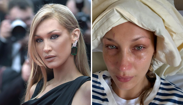 FOTO Pokazala je sve u 'golim haljinama',  s 14 godina išla pod nož: Ovako se mijenjala Bella