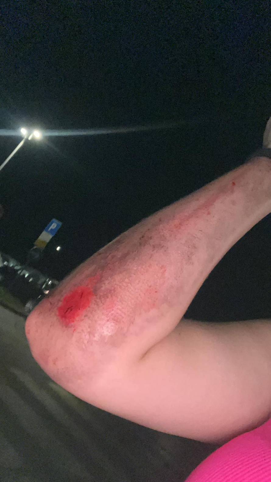 Policija otkrila koja kazna čeka vozača ZET-a koji je u Zaprešiću vukao djevojku (17) po ulici...