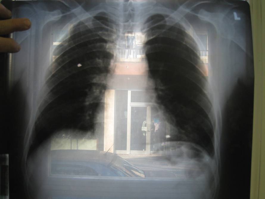 Duško Mirković/PIXSELL