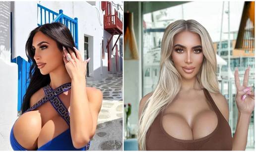 Posljednja objava dvojnice Kim Kardashian: Bila je pozitivna, a preminula je nakon operacije...