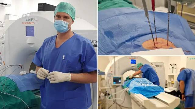 U Zagrebu su zamrzavanjem ubili rak: Novi pacijenti već za dva tjedna mogu ići na zahvat