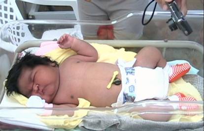 Žena (42) iz Brazila rodila je djevojčicu tešku 7,1 kilogram
