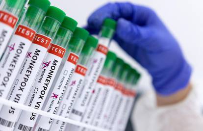 Njemačka naručila cjepivo za majmunske boginje, Francuska preporuča ciljanu kampanju