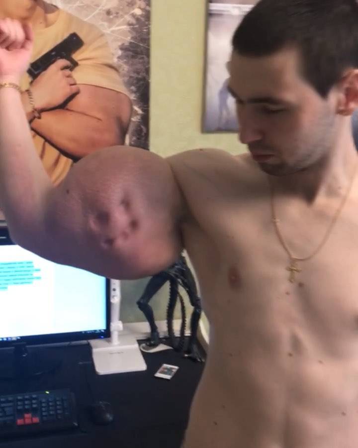 Skoro je ostao bez ruku, ostavio se MMA i počeo snimati porniće