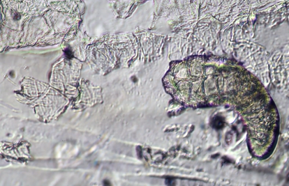 Jeste li znali? Ova se bića pare na vašem licu dok spavate...