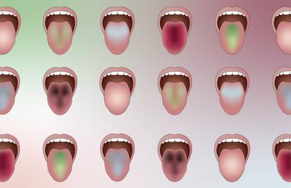 Novi AI čita boju jezika i predviđa bolesti: Digitalna dijagnostika ulazi u mainstream