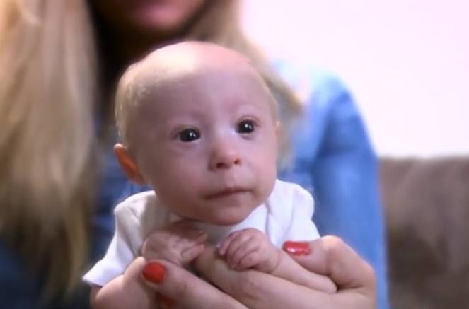 Mali princ: Matthew ima sedam mjeseci i samo 1,6 kilograma