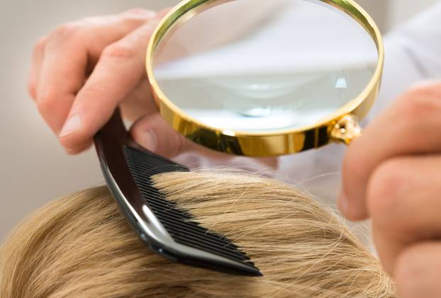 Dermatologist Looking Blonde Hair Through Magnifying Glass
