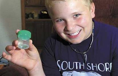 Liječnici u uhu dječaka (9) pronašli žive pauke