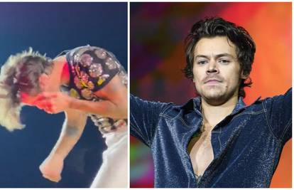 I Harry Styles je postao žrtva bizarnog trenda na koncertima: Pogodili su ga nečime u glavu