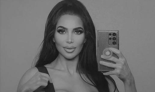 Preminula je dvojnica Kim Kardashian: Bila na plastičnoj operaciji pa imala srčani udar