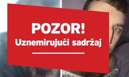 Žrtva Millwallovih huligana: Ne mogu se pogledati u ogledalo