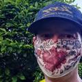 Liječnik trčao s maskom 35 km i srušio mit o zasićenosti kisikom