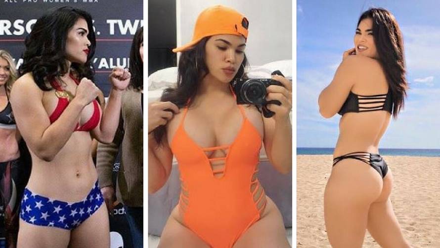 Pretučena UFC-ova ljepotica, sumnjaju  na obiteljsko nasilje