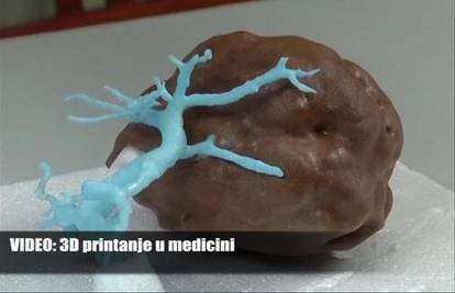 3D medicina: Isprintali organ kako bi uvježbali operaciju