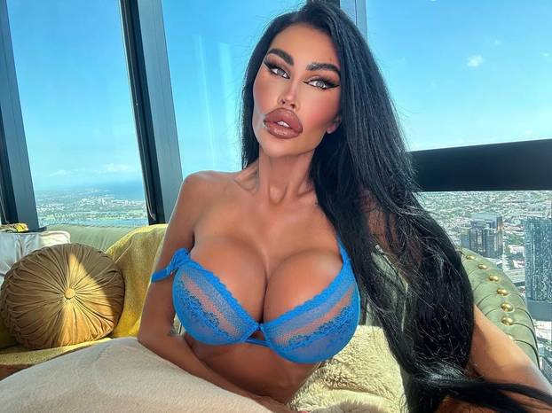 FOTO Potrošila više od 100 tisuća eura kako bi izgledala kao 'ljudska barbika' - Liječnici zgroženi