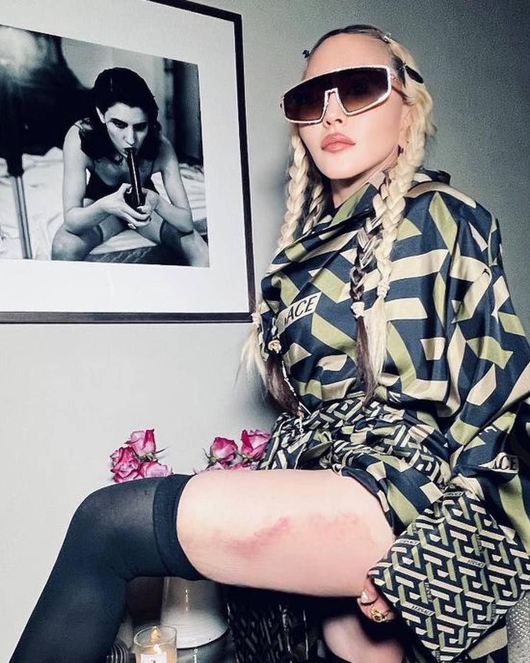 Madonna pozirala u čipkastom grudnjaku i fanove zabrinula modricama: 'Život me prebio!'