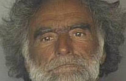 Muškarac (65) kojem je kanibal izgrizao lice potpuno je slijep