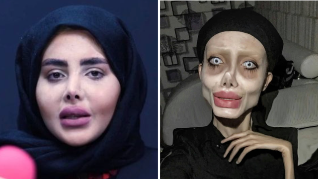'Zombie' Angelina Jolie pravo lice otkrila je nakon zatvora: Evo kako se uspjela proslaviti...