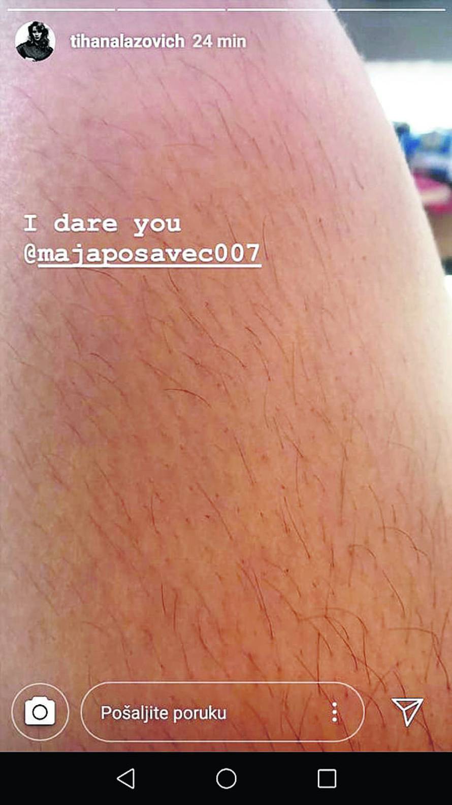 Hrvatice slijede trend: Glumice pokazale dlakave noge i pazuhe