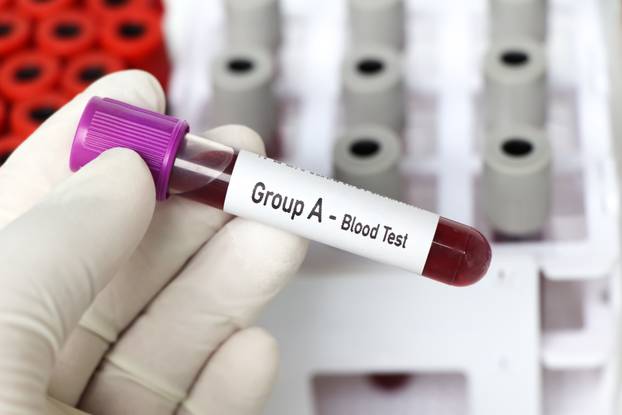 Group A- Blood Test, blood sample to analyze in the laboratory