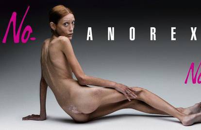 Plakati anoreksične djevojke preplavile Italiju