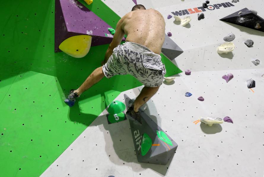 'Djeca su se rugala, prstom su upirali u mene, bilo mi je teško'