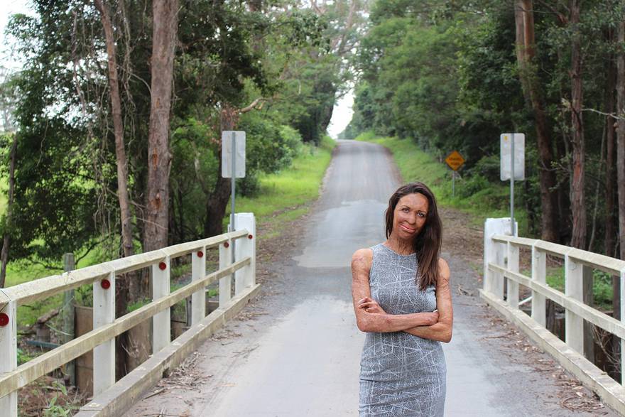 turia pitt