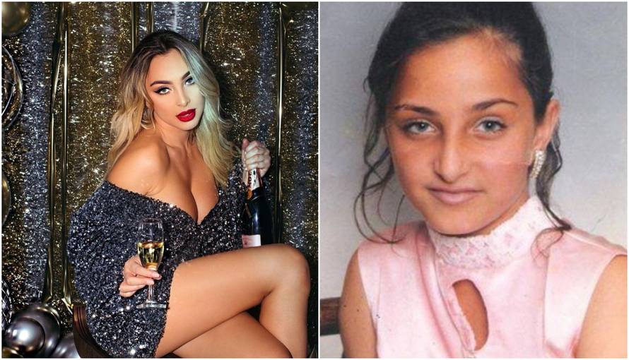 Maya Berović je 'iskeširala' 30.000 kuna za operaciju brade